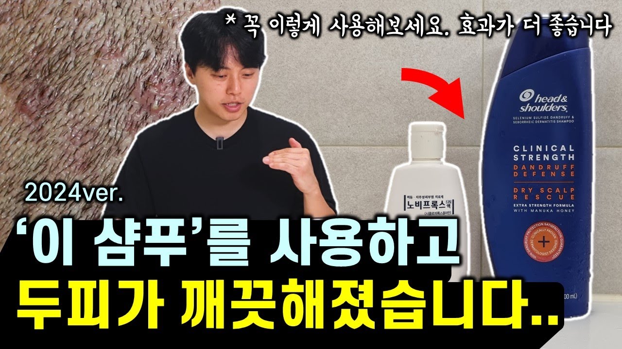 의사가 추천하는 지루성 두피염 샴푸 200% 활용법 (feat. 효과 좋은 샴푸 1위, 사용 꿀팁, 광고❌️)