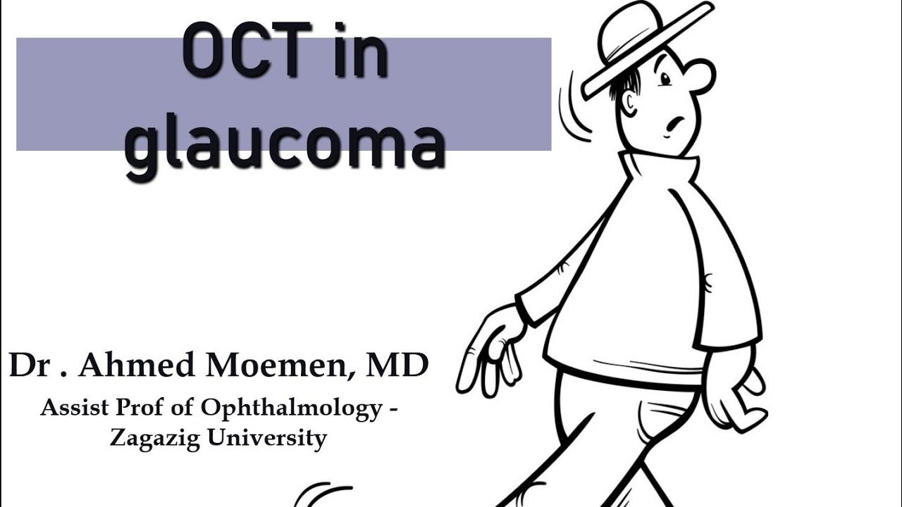 OCT in glaucoma (watch your step)
