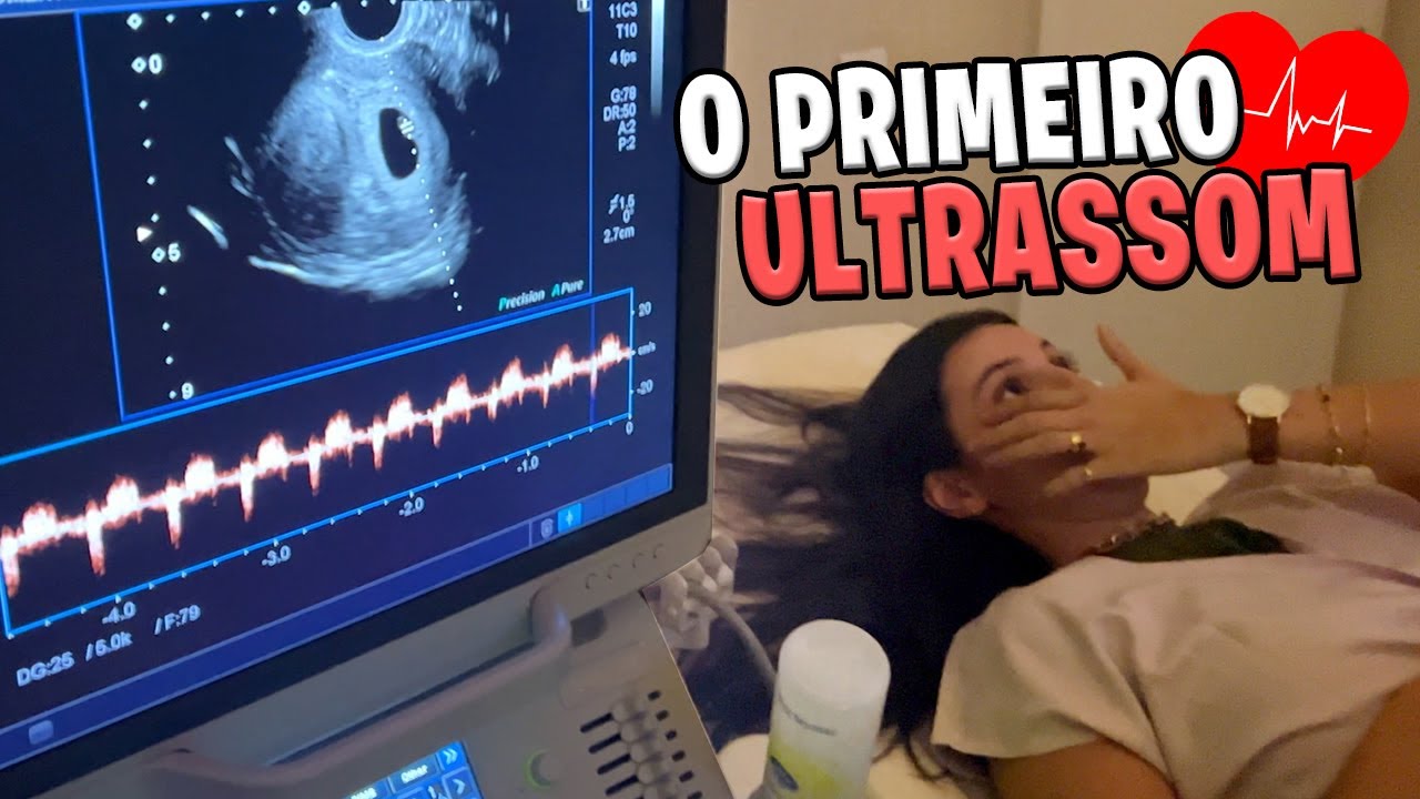 Primeiro ultrassom do Bebê Landim! Ouvimos o coraçãozinho e choramos muito!