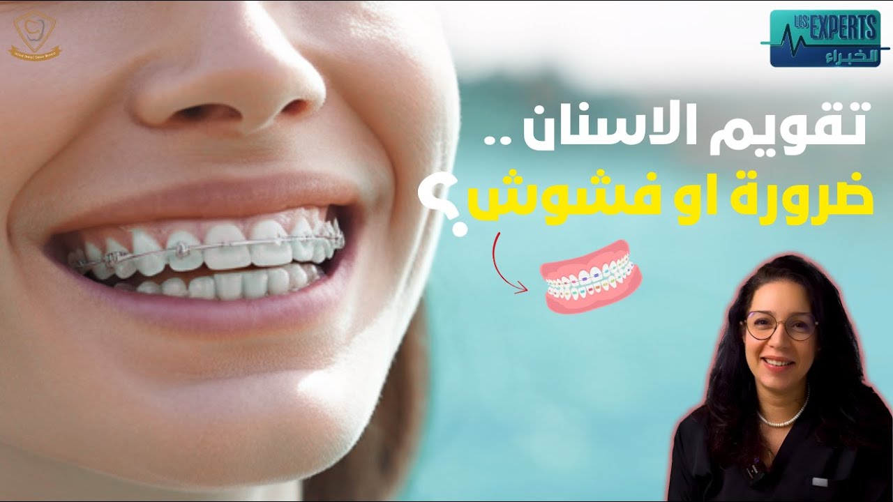 تقويم الاسنان .. ضرورة او فشوش؟ مع الدكتورة فاطمة الزهراء كنيس في برنامج الخبراء