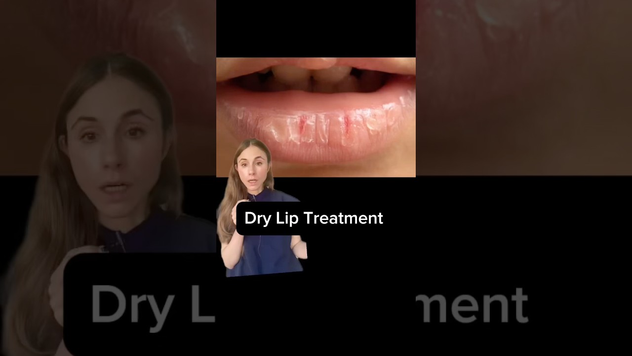 Dermatologists Reveal Ultimate Dry Lip Solutions