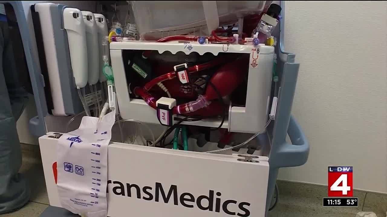 New technology a 'game changer' for organ transplants