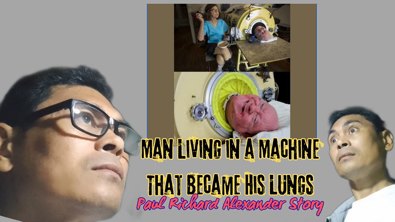 Man Living in a Machine That Became His Lungs #shareyourstory