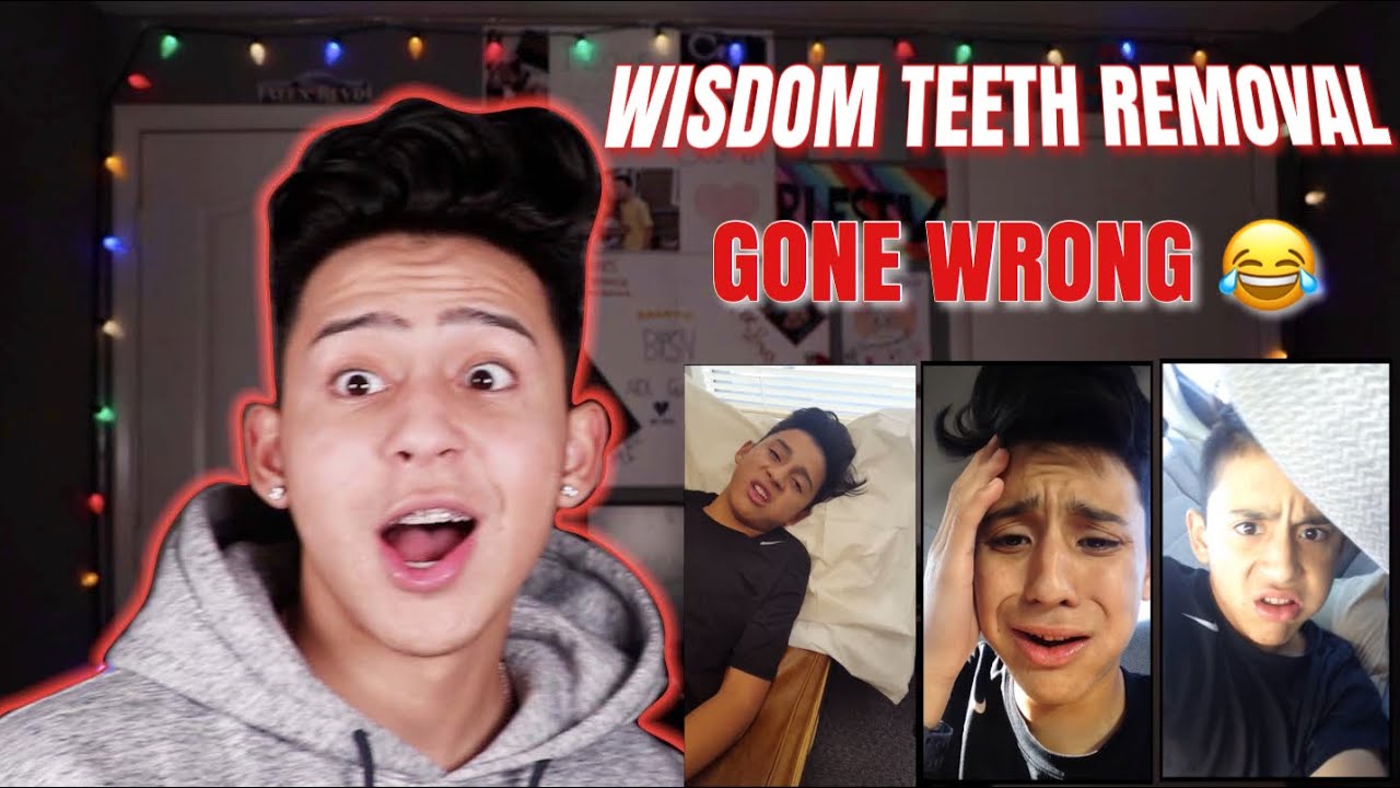 REACTING TO MY WISDOM TEETH VIDEOS | ALEX GUZMAN