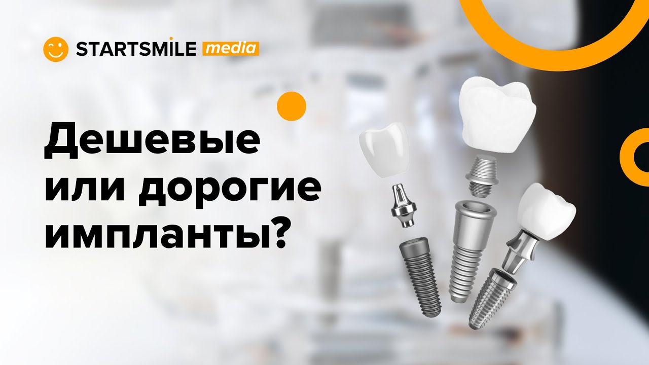 Как правильно выбрать зубной имплант?
