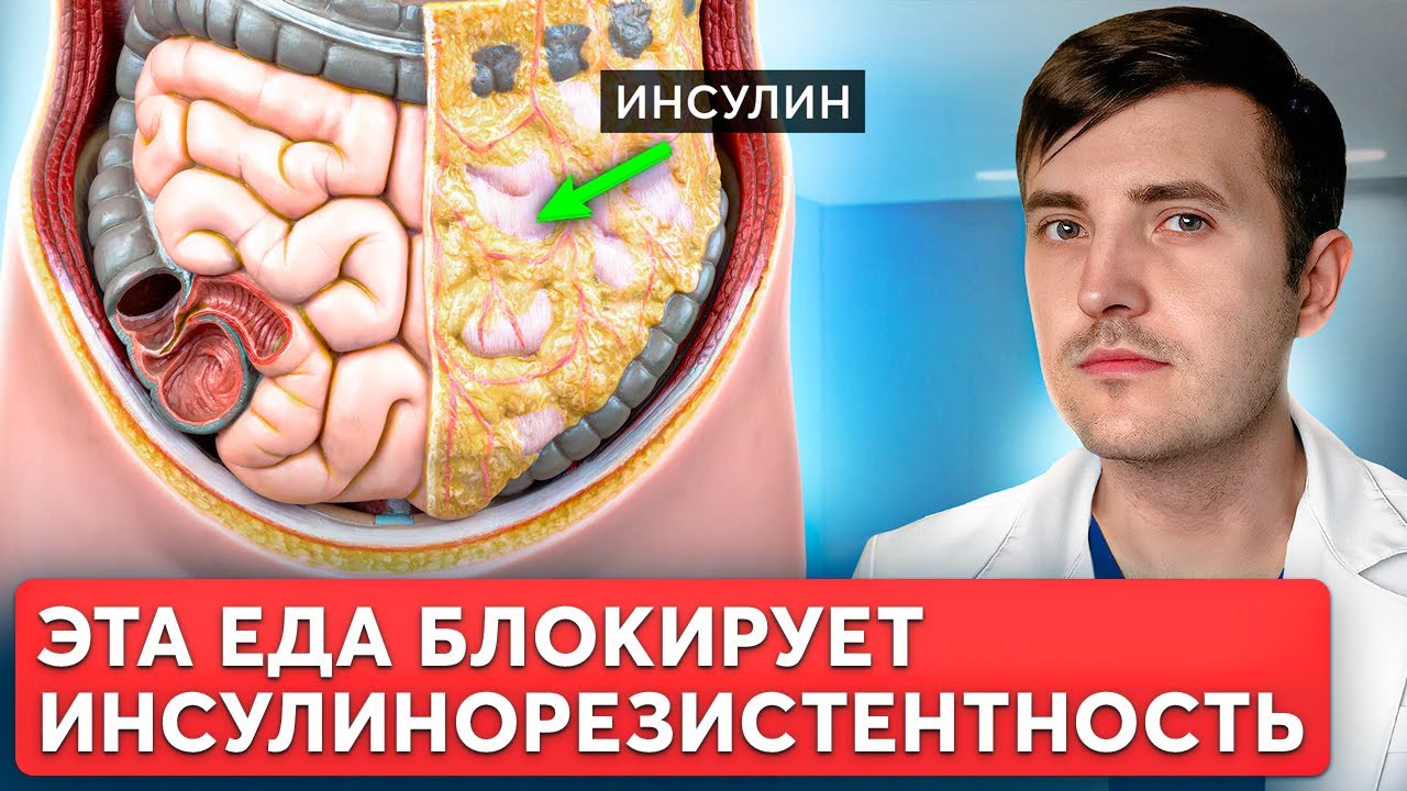 Как худеть при инсулинорезистентности? Продукты, которые ее остановят!
