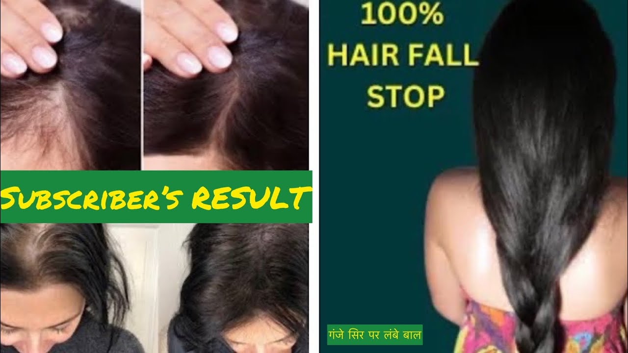 30 Days Hair Growth Challenge : Onion Juice for Hair | How to make your Hair grow Super Fast ❤️