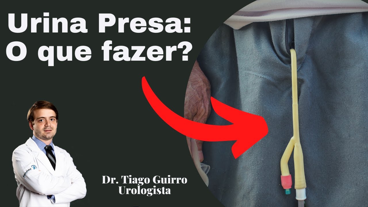 Urina Presa: O que Fazer? Retenção Urinária