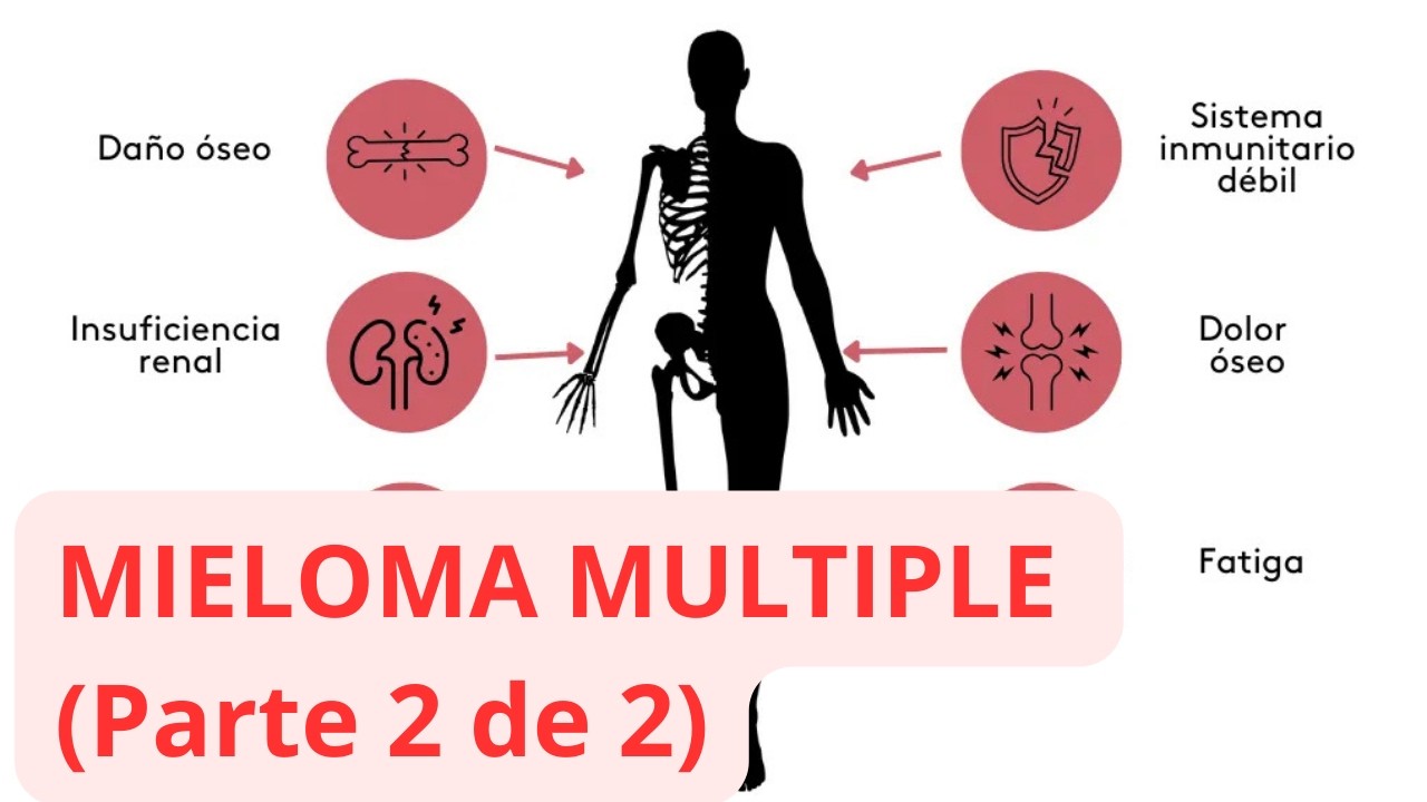 Mieloma Multiple (Parte 2 de 2) preguntas y respues clave respondidas