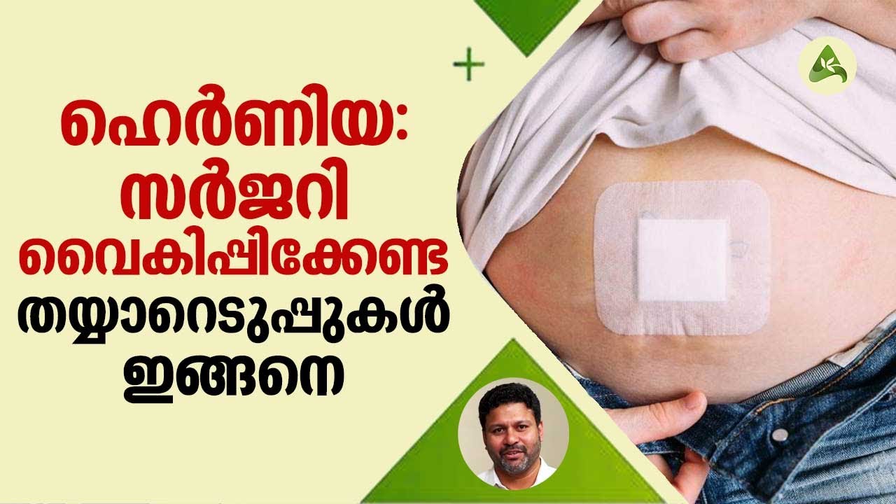 Hernia Surgery | ഹെർണിയ: സർജറി വൈകിപ്പിക്കേണ്ട; തയ്യാറെടുപ്പുകൾ ഇങ്ങനെ | Arogyam