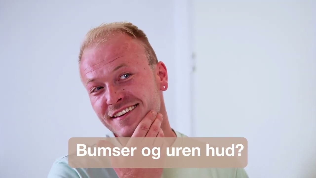 Ansigtsmaske til uren og fedtet hud - Dybderensende ansigtsmaske mod hudorme og bumser