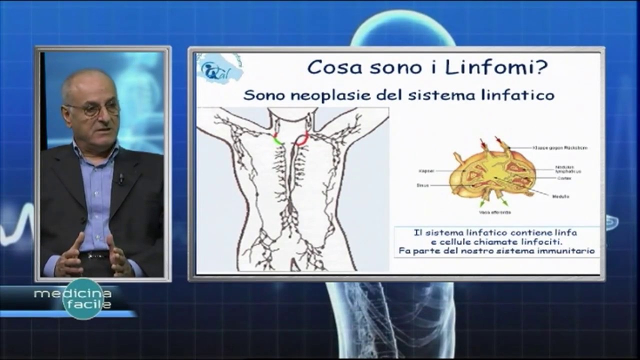 Medicina Facile - Linfoma di Hodgkin, diagnosi e cura