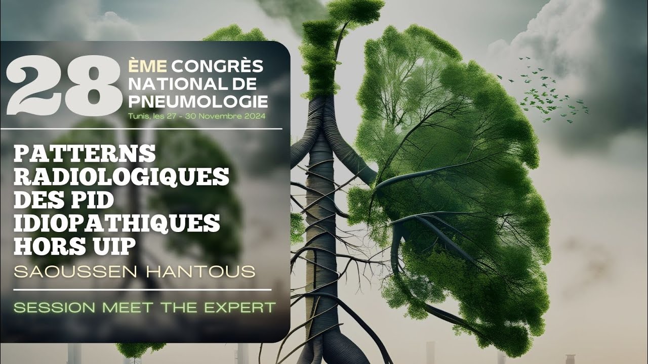 Patterns radiologiques des PID idiopathiques hors UIP. Saoussen Hantous
