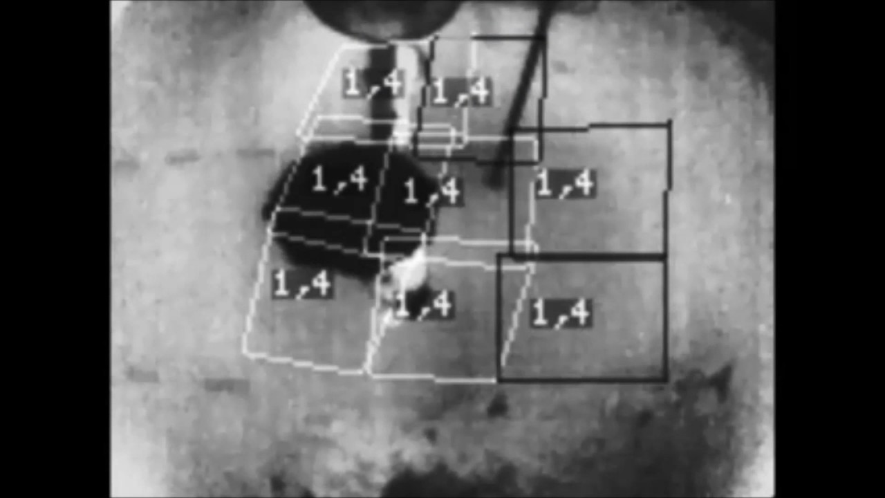 FLIR Trafione Pedestrian - Smart Detection