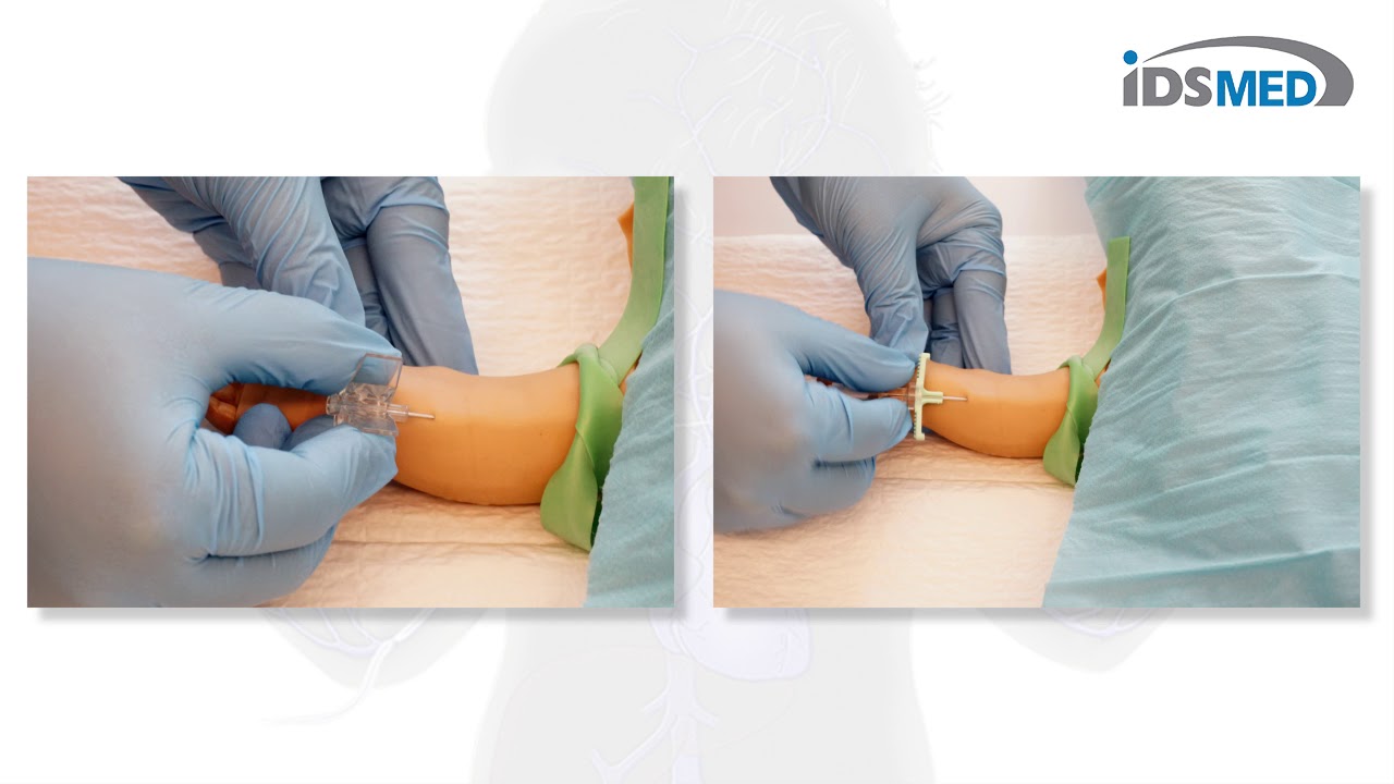 Vygon | PICC Neonate