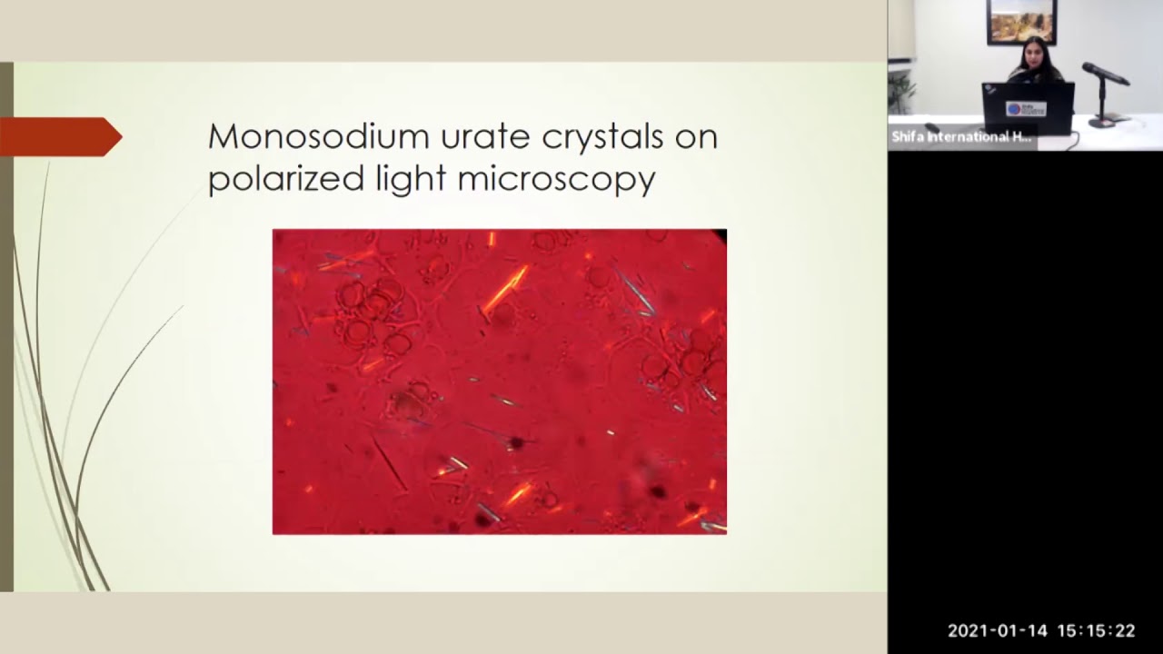 3. Masterclass in Rheumatology - Gout by Dr. Taha Akhtar