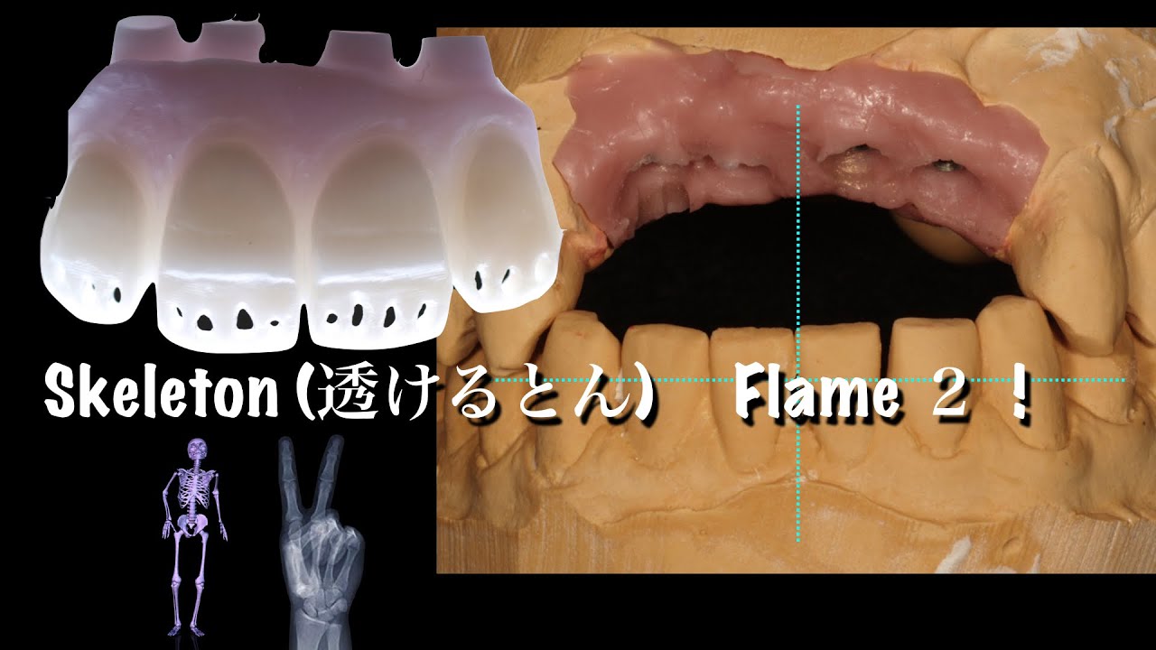 Skeleton Frame 2     Noritake CZR build up　internal stain technique #歯科技工　＃skeleton  #Noritake CZR