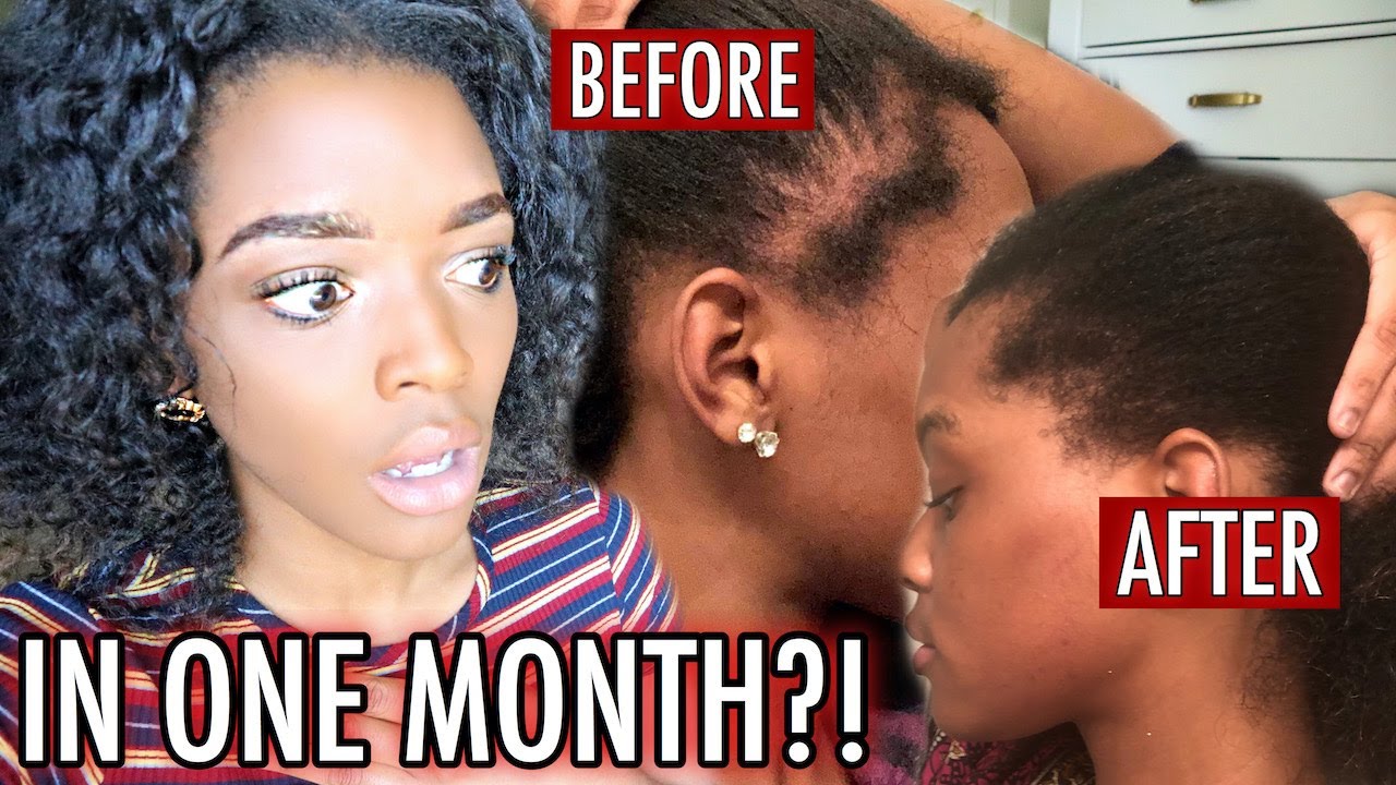 HOW I GREW MY EDGES BACK IN ONE MONTH (NOT CLICKBAIT)