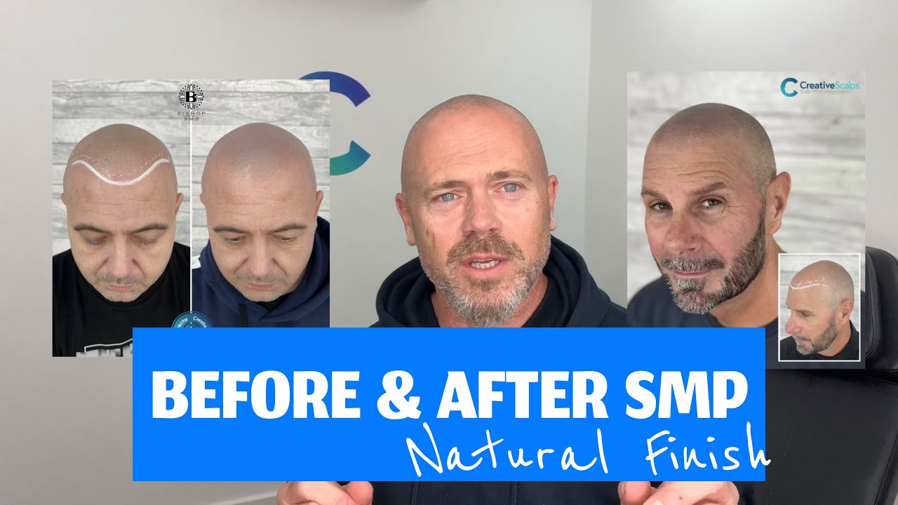 Natural Finish SMP: преображения до и после | Creative Scalps