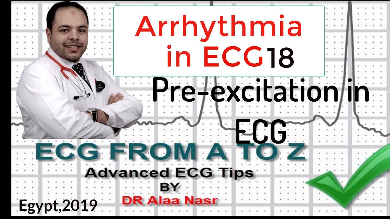 ECG from A to Z, intermediate level, Arrhythmia 18, Dr Alaa Nasr, 2019