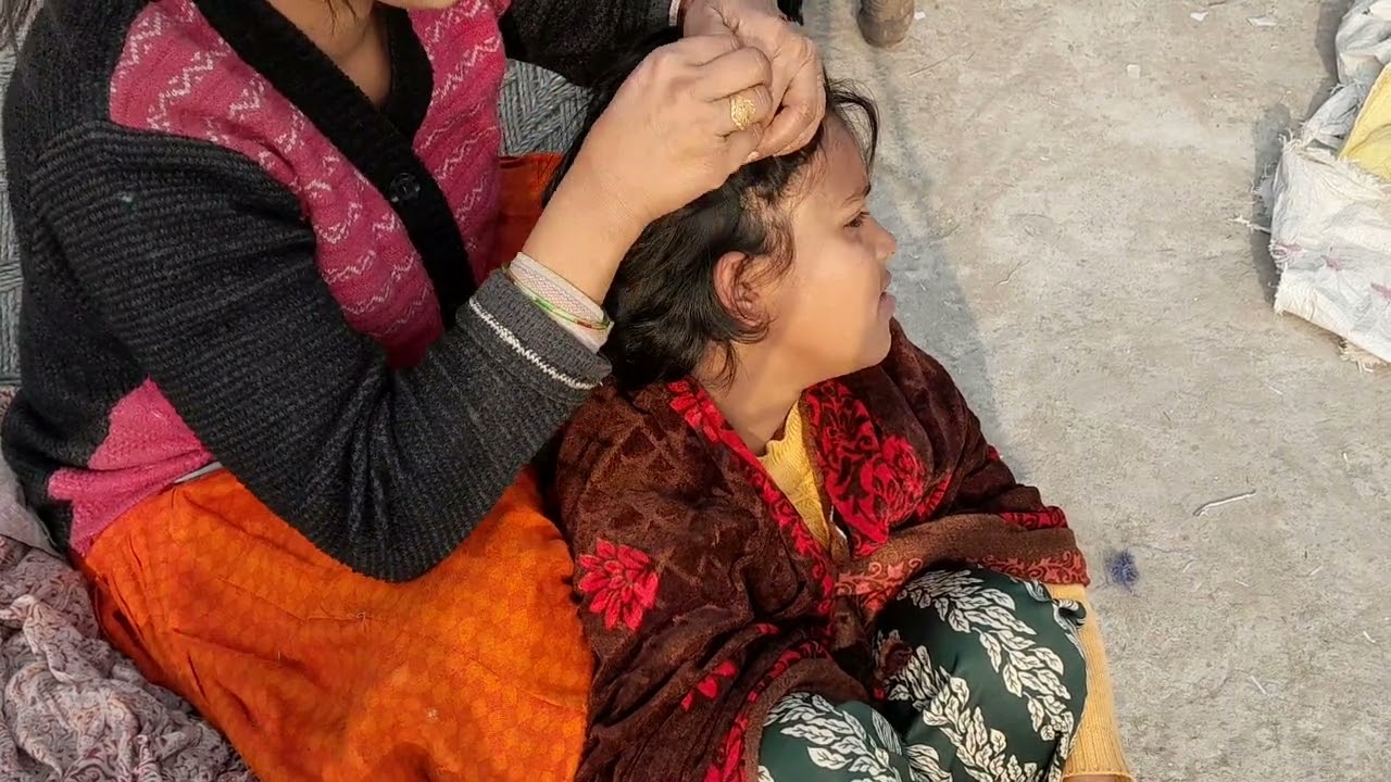 Heavy Nitpicking in long hair new 