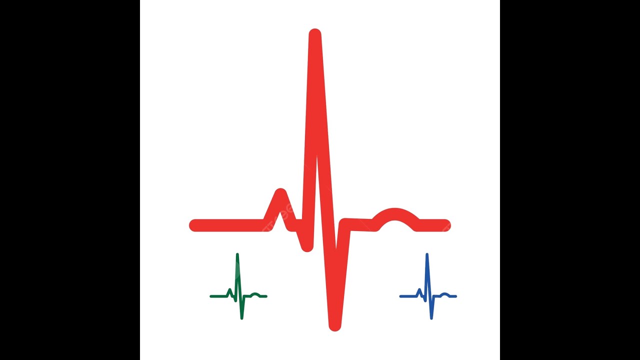DESPOLARIZACION VENTRICULAR - DERIVACIONES