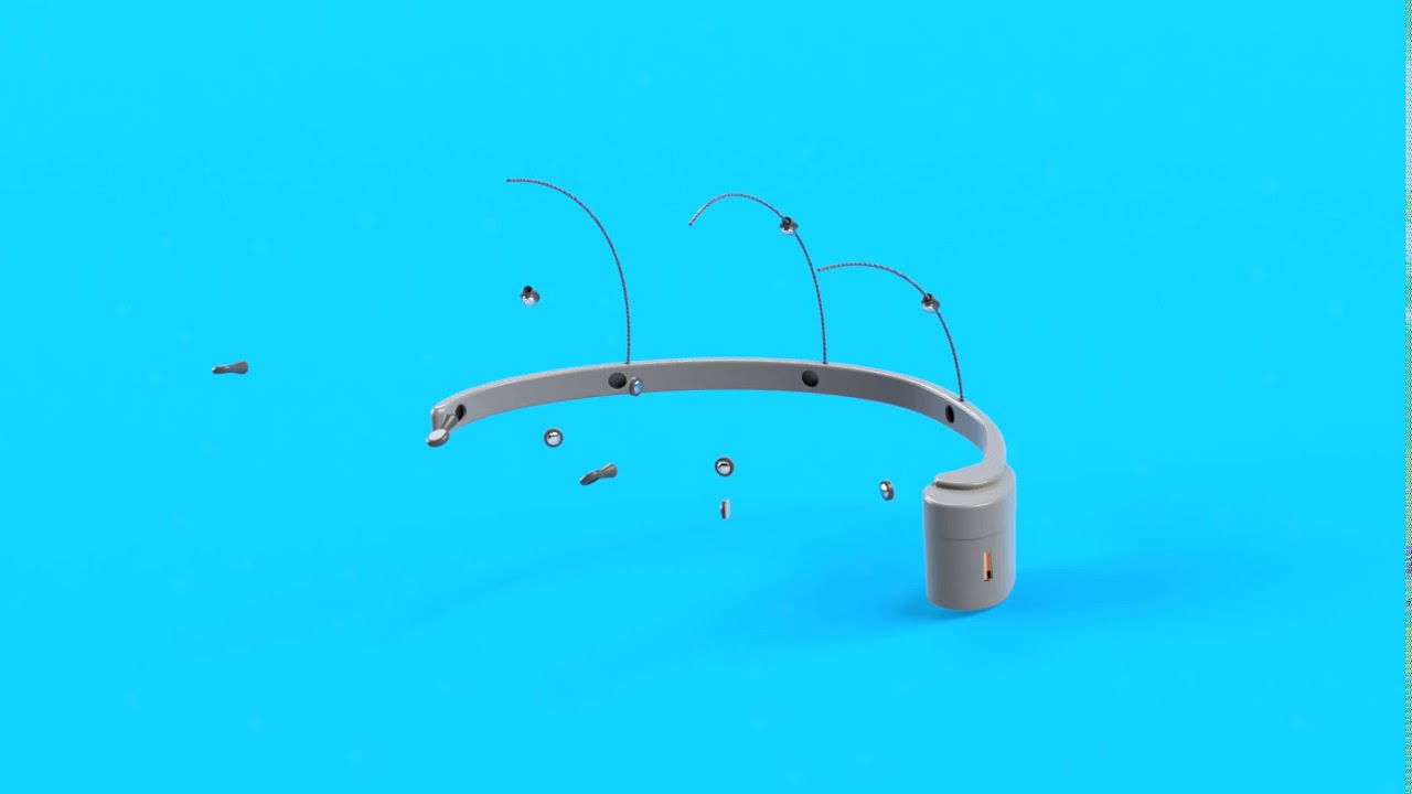 Wearable EEG device for tracking brain activity