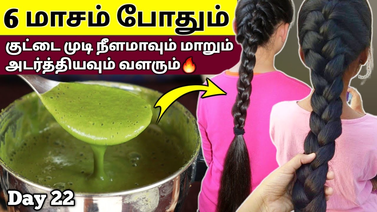 🔥6 மாசம் போதும்😱 குட்டை முடி நீளமாவும் மாறும்  அடர்த்தியவும் வளரும் - 30 days challenge Day 22