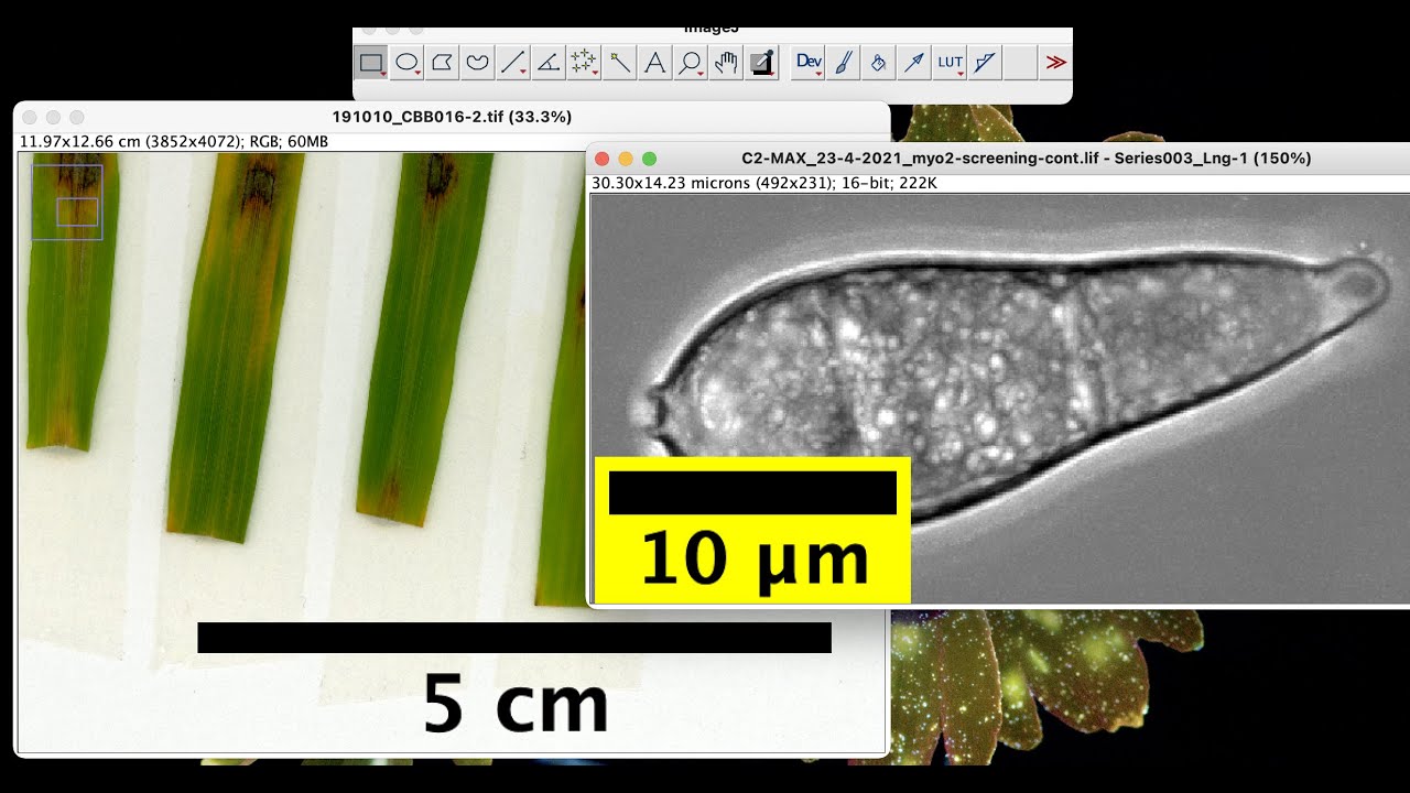 Как установить масштабную линейку в imageJ на изображениях с микроскопа и камеры | калибровка изо...