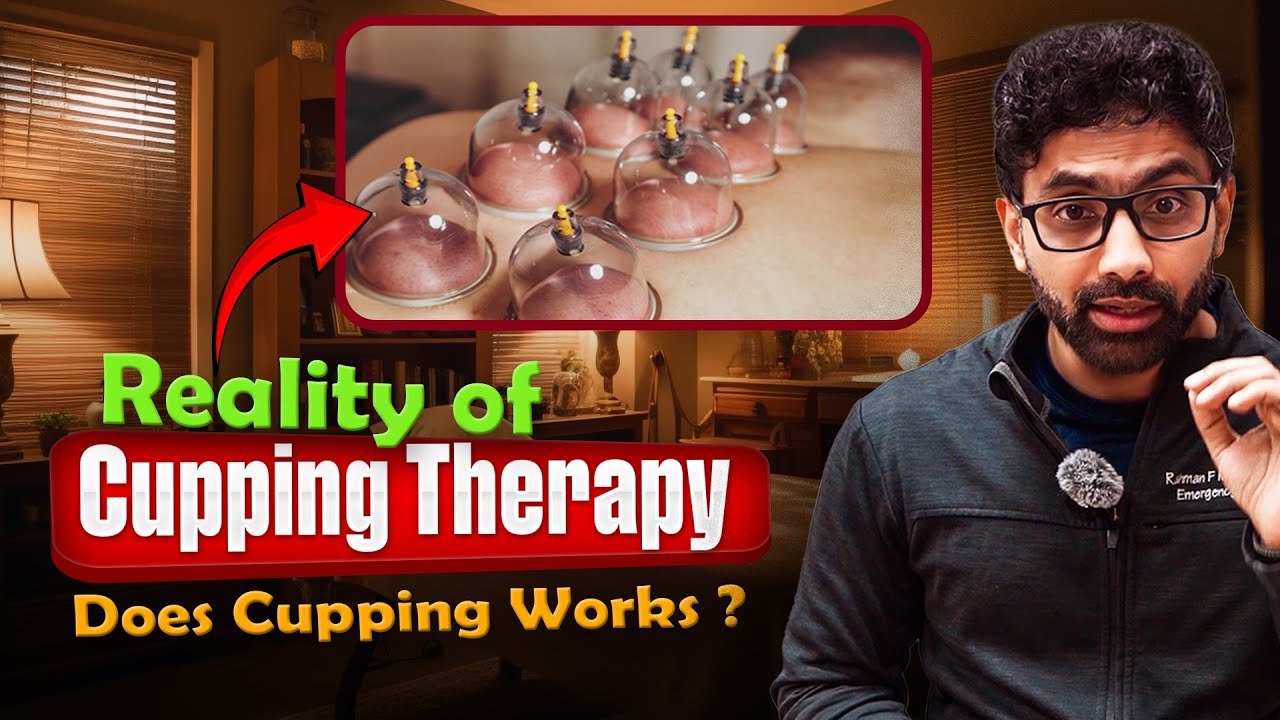 Cupping Therapy (Hijama) Explained | Ancient Healing or Modern Hype?