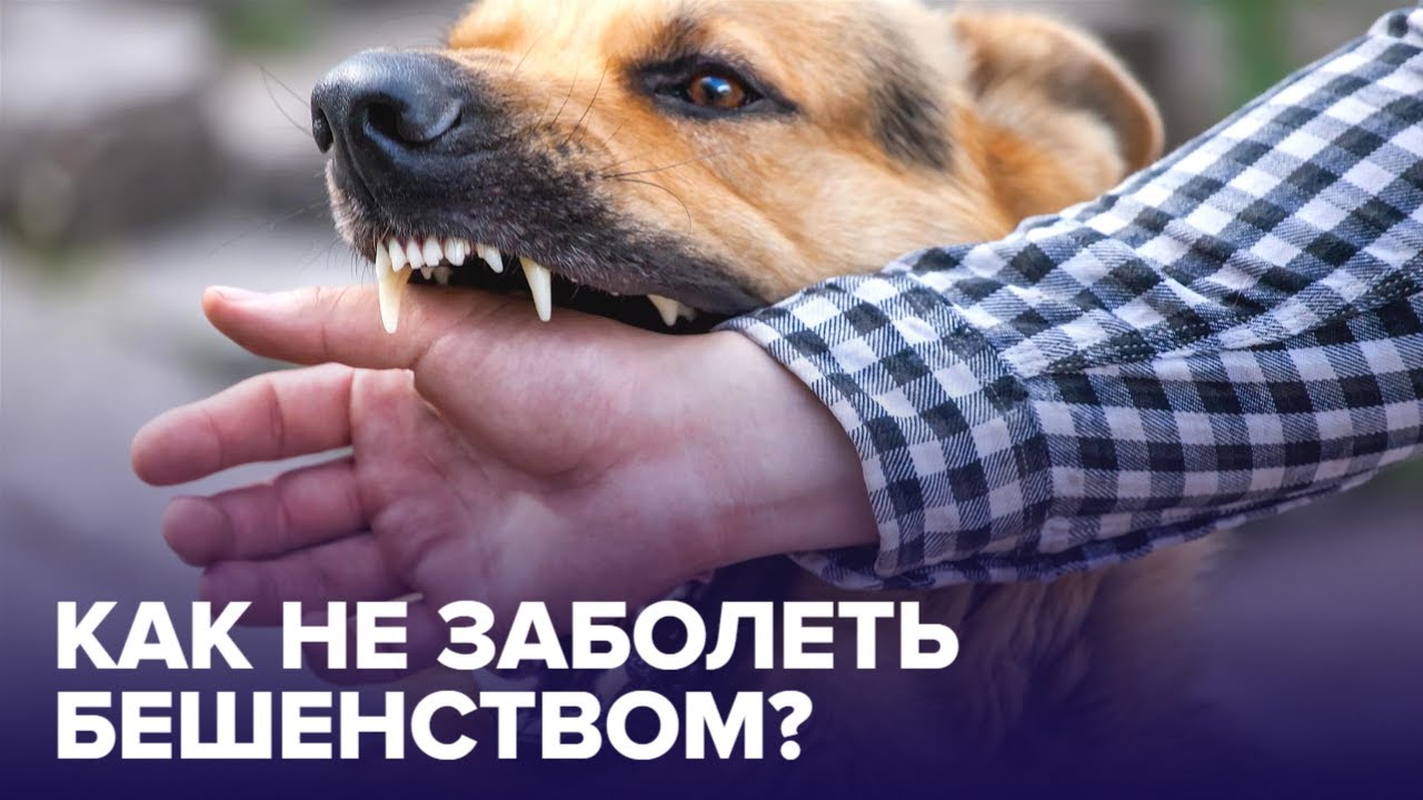 БЕШЕНСТВО: как защитить себя от смертельно опасной болезни?