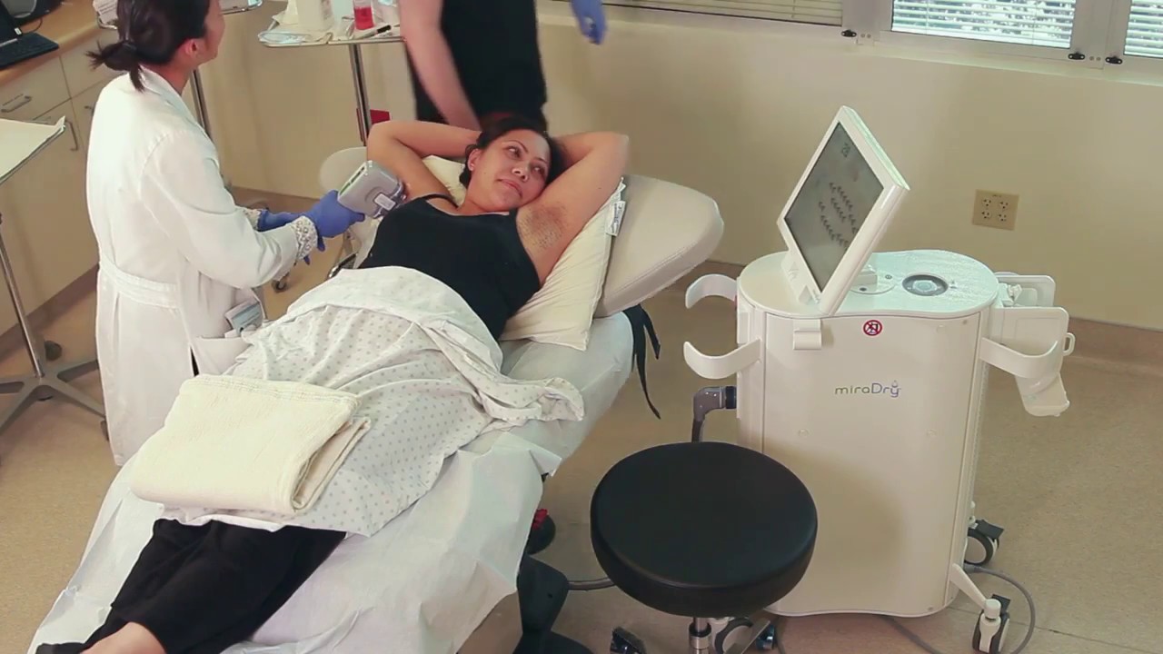 MiraDry Mountain View - Permanent Cure for Underarm Sweating