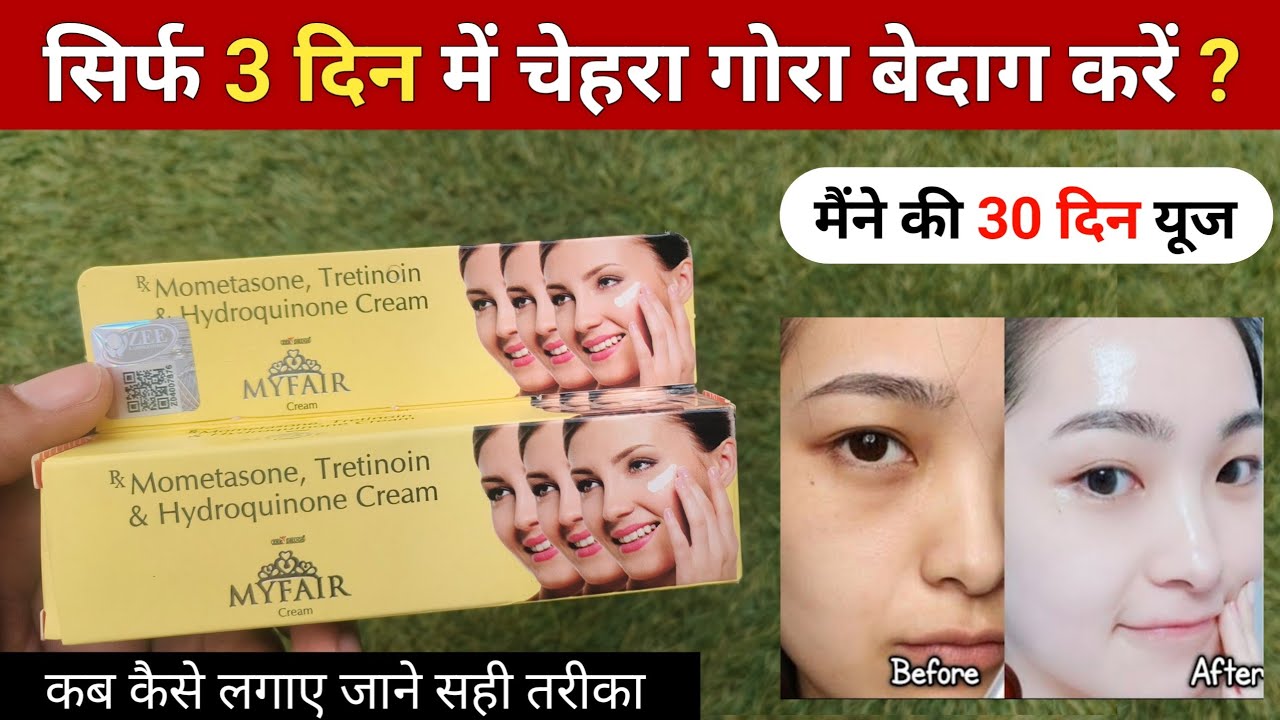 My Fair Cream Review 2026 | my fair cream kaise use kare | myfair cream 