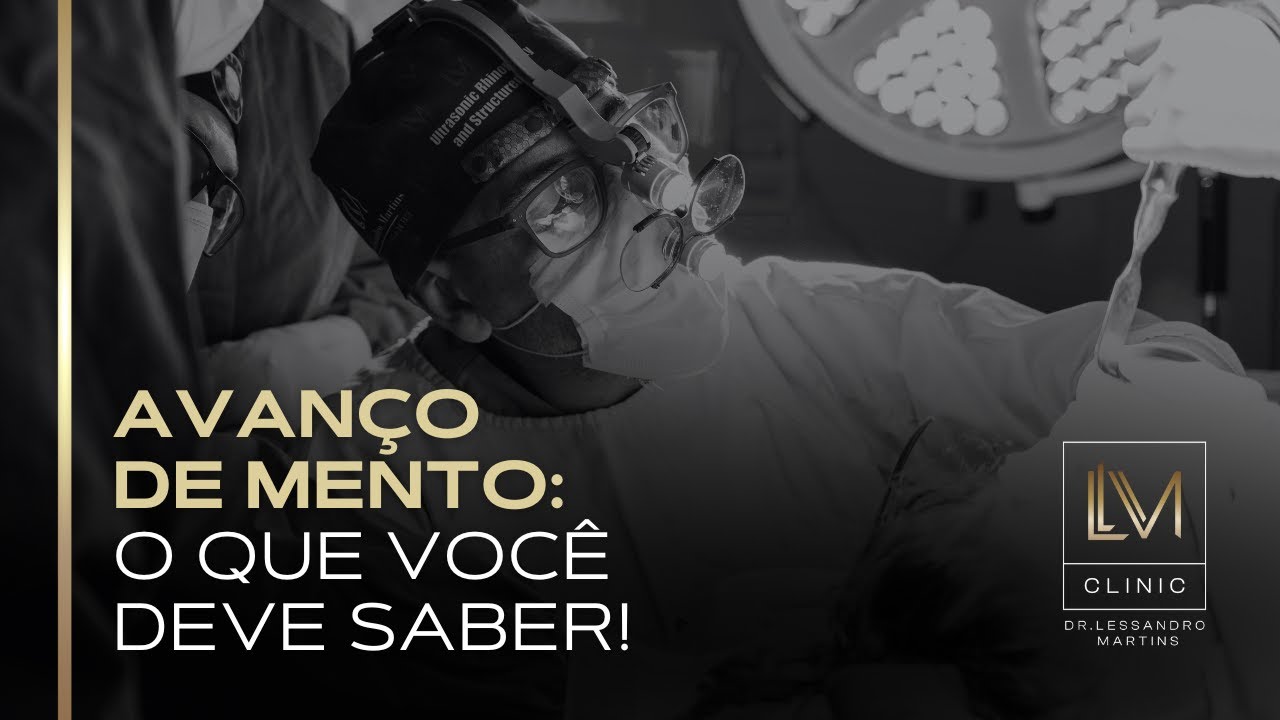 AVANÇO DE MENTO: O QUE VOCÊ DEVE SABER!