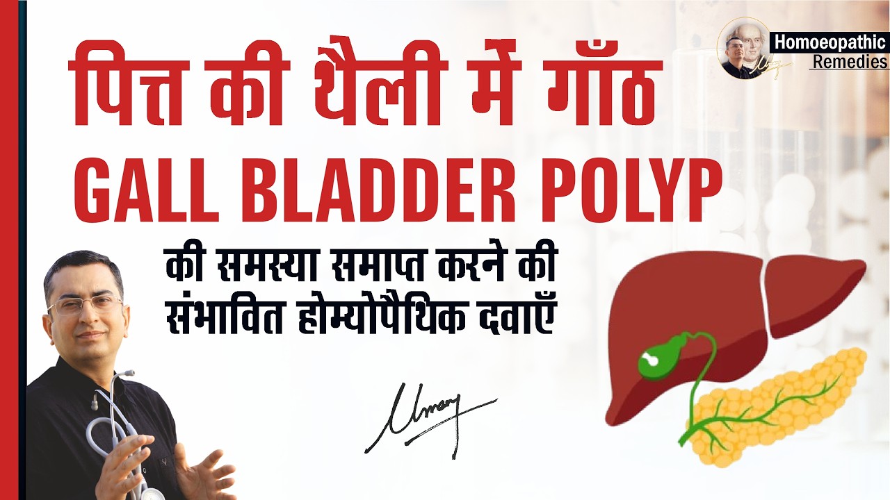 पित्त की थैली में गाँठ || Gall Bladder Polyps || Natural homeopathic remedies with symptoms