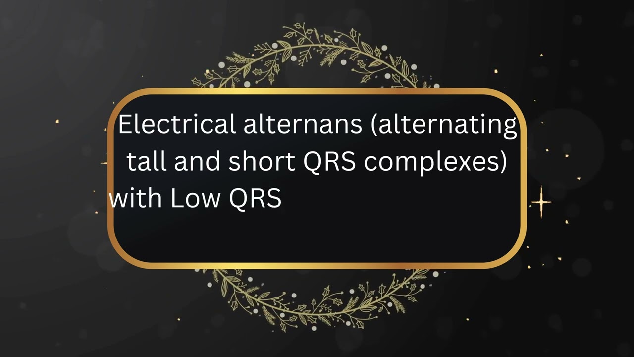 10 Killer ECG patterns 1