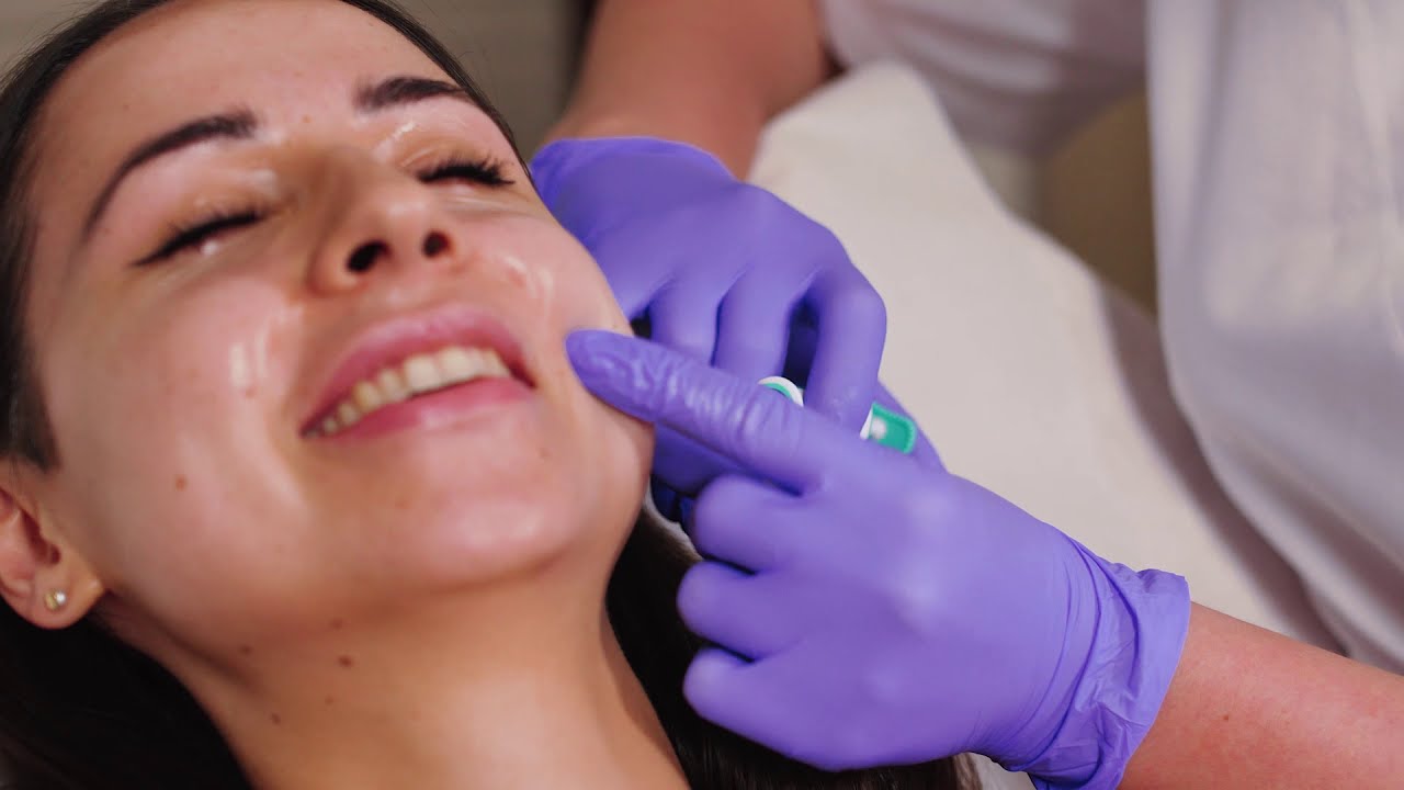 Mezoterapia igłowa kwasem VOLITE Juvederm. Zobacz piękny efekt GLOW na sk&oacute;rze #mezolifting