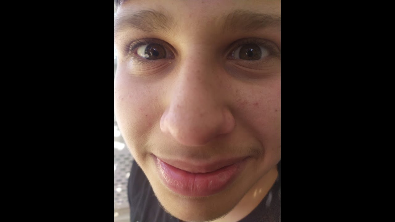 לייב רוקט ליג עם אבובה