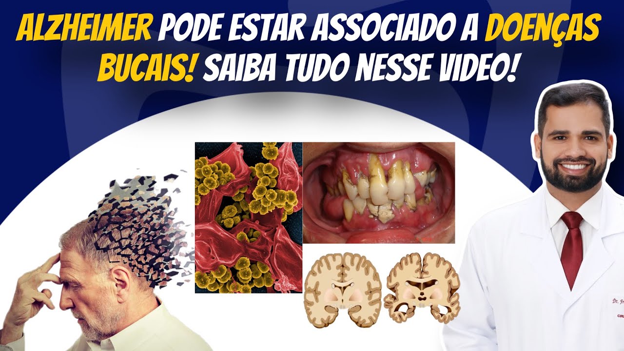 Alzheimer e doenças bucais, qual a relação? Tudo sobre, nesse vídeo! #alzheimer #periodontitis