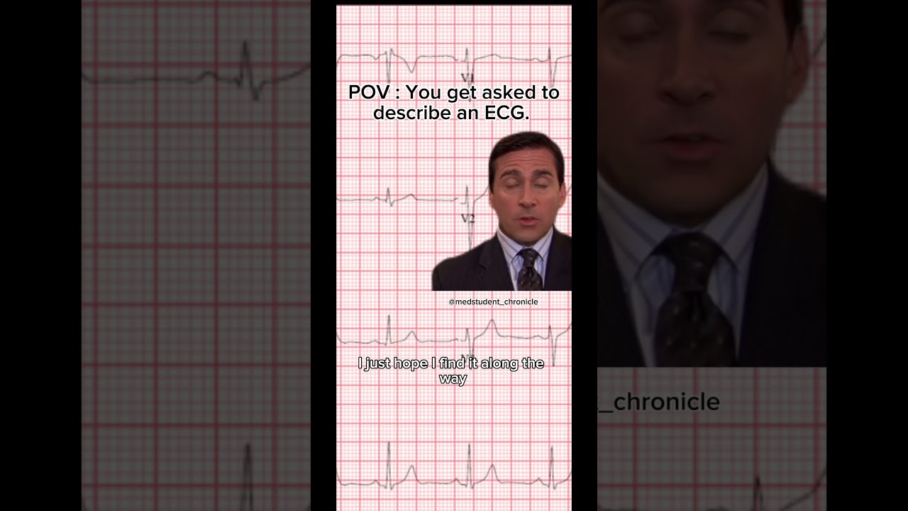 POV : You get asked to read an ECG as a medical student 