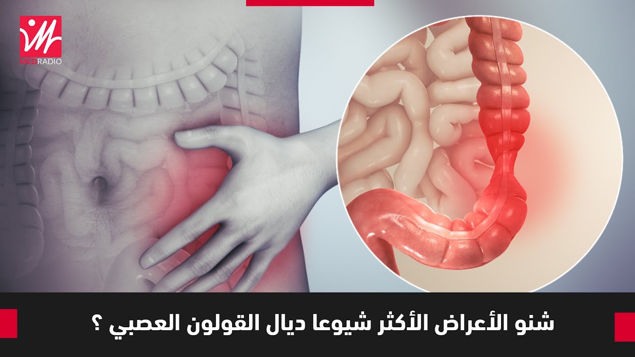 صحة وسلامة.. شنو الأعراض الأكثر شيوعا ديال القولون العصبي ؟