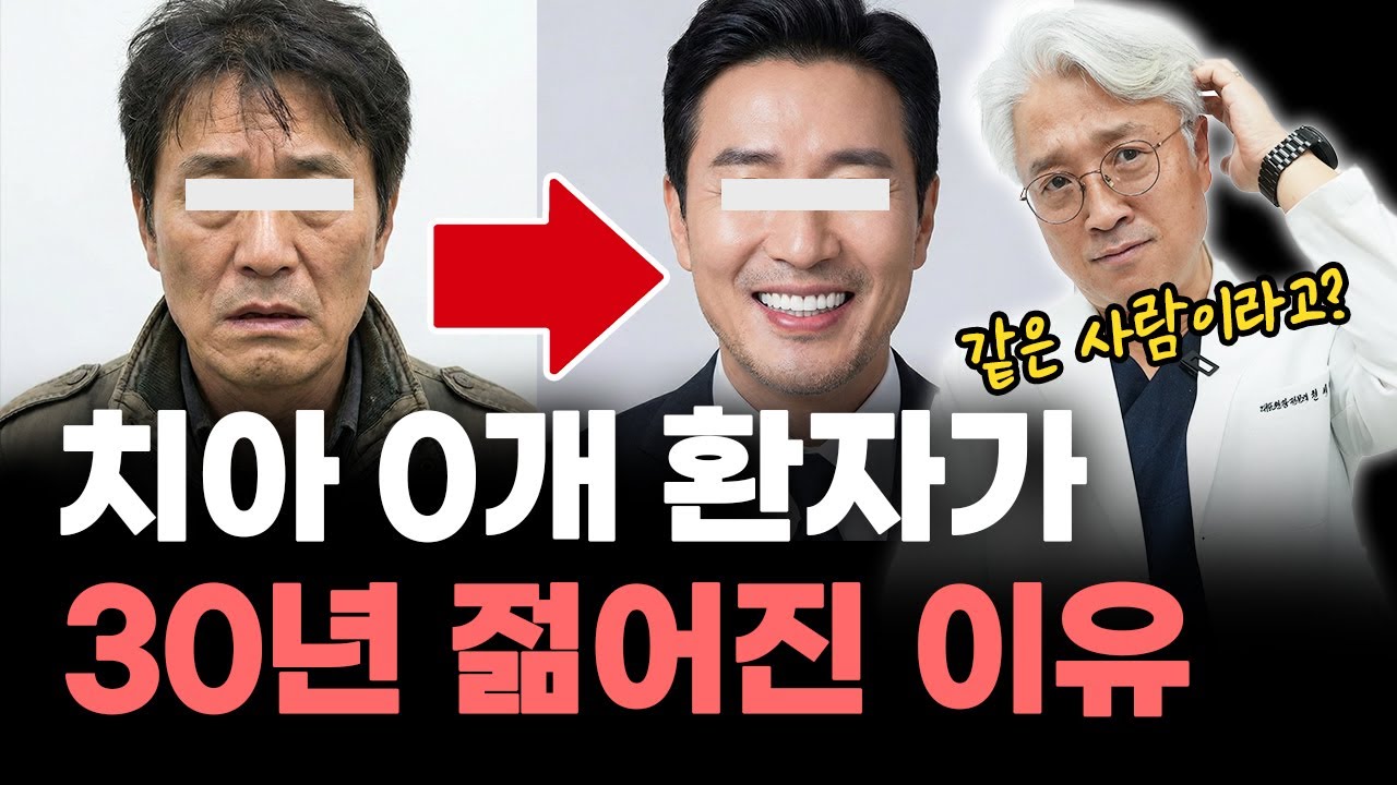 치아 0개 환자가 30년 젊어진 결정적 이유 (feat. 잇몸뼈 부족해도 임플란트 가능할까?) [인천치과, 미추홀구치과]