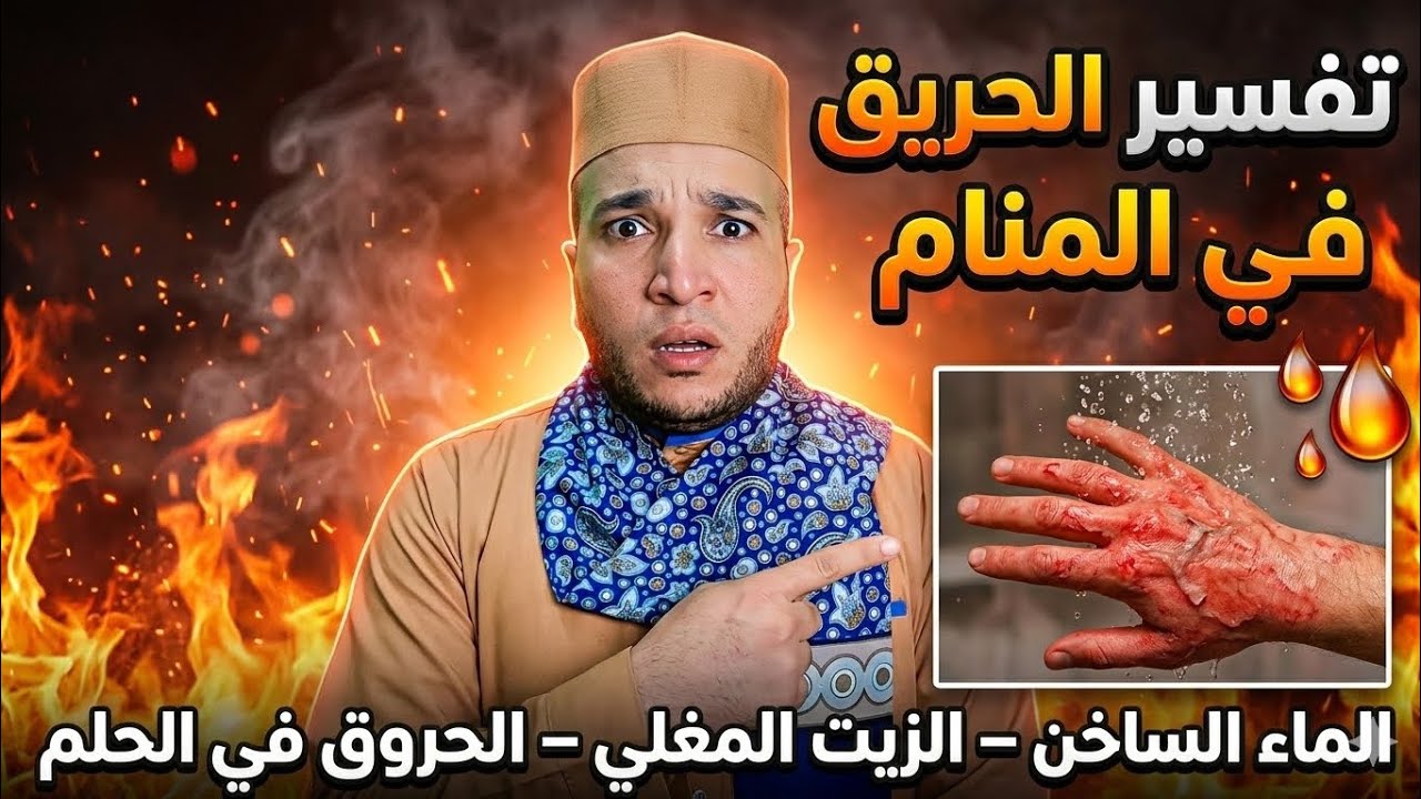 تفسير الحريق والحروق في المنام | الماء الساخن والزيت المغلي في الحلم ماذا يعني؟