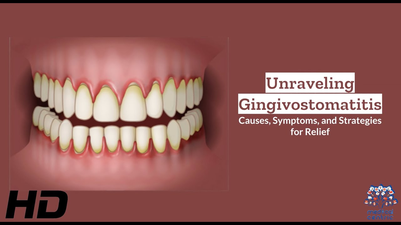 Gingivostomatitis Awareness: Navigating the Road to Recovery