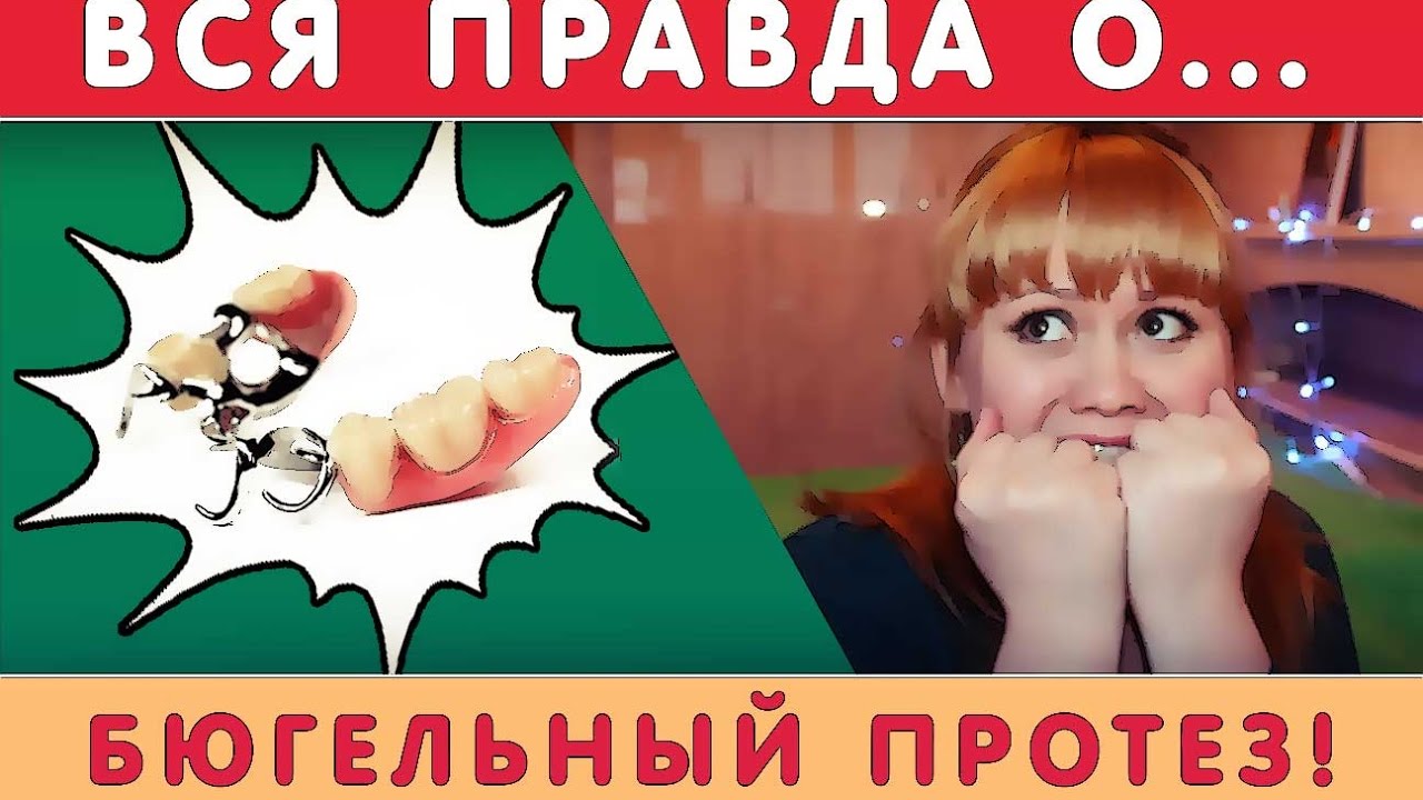 20. Съёмный Бюгельный протез. Плюсы и минусы