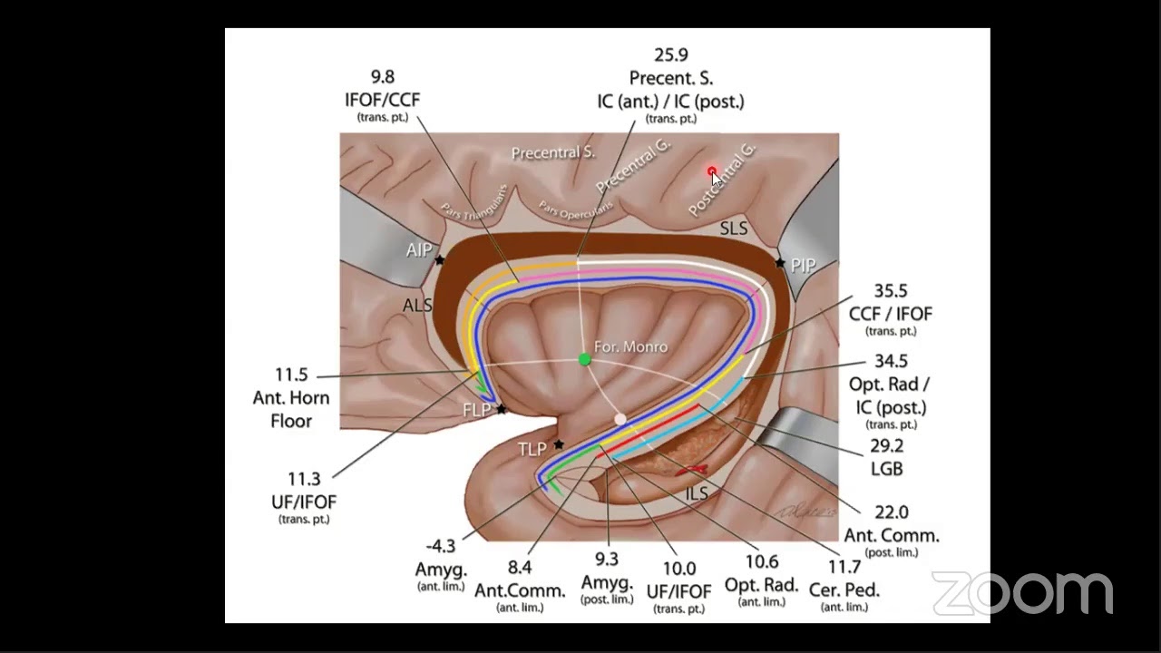 Anatom&iacute;a del Central Core (N&uacute;cleo Central) - Nadin J Abdal&aacute; Vargas, MD