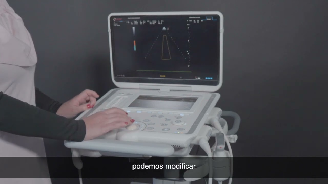 Conoce la tecnología de ultrasonido Esaote para cardiología