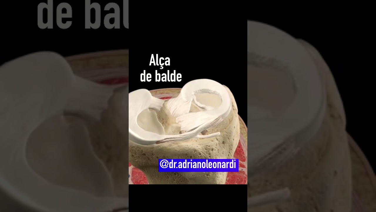 Les&atilde;o do menisco: O que acontece se n&atilde;o operar?￼