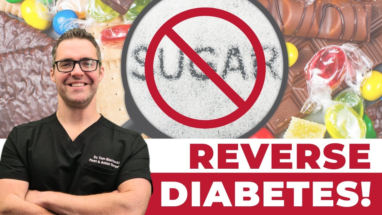 🧁86% Reversed Type 2 Diabetes [Best Diabetes Diet]