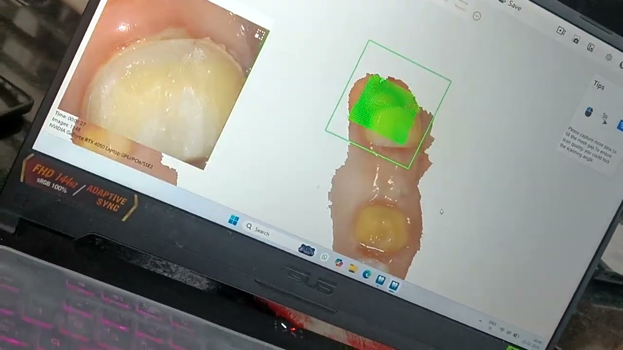 Intraoral scanner 🦷✨☎️02591796340